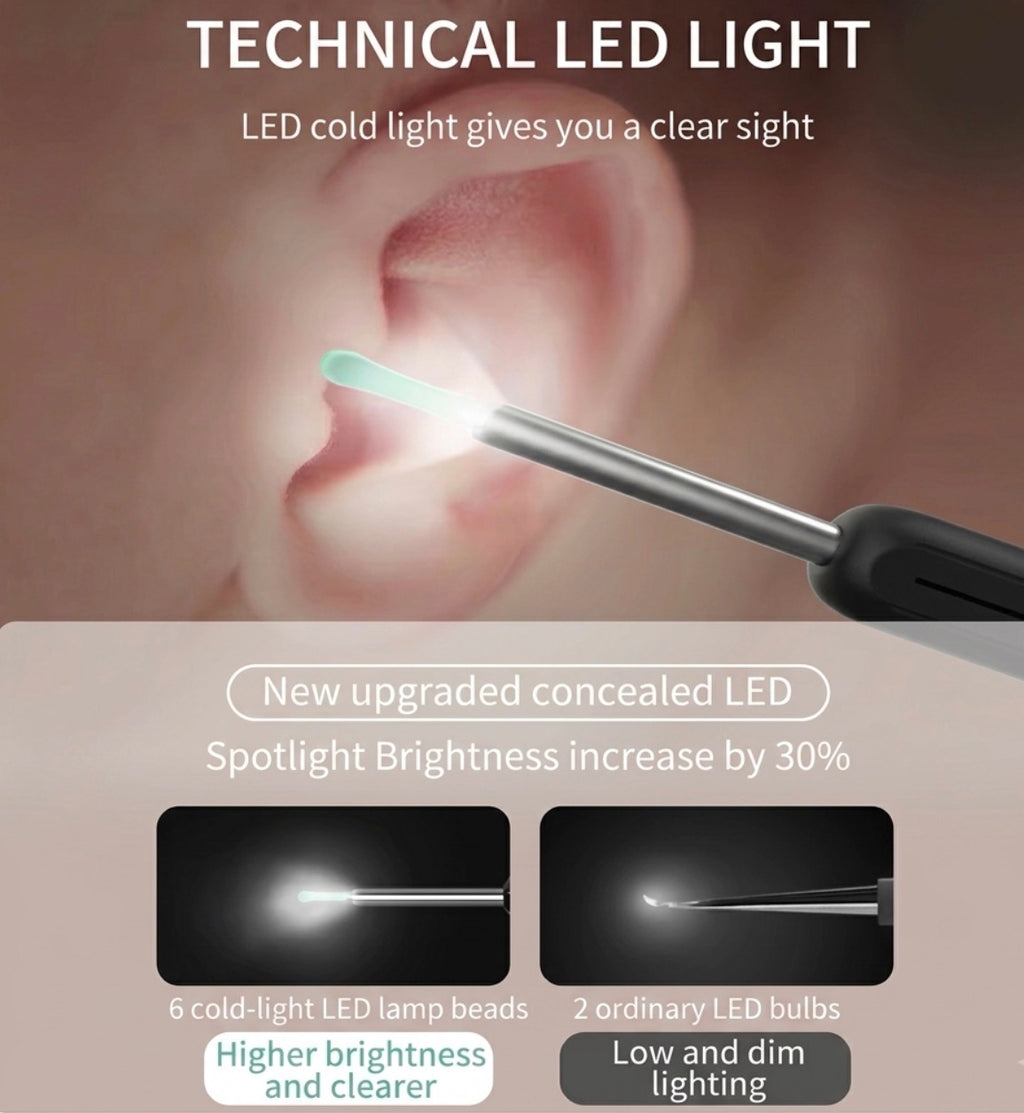 Smart Ear Cleaning Kit with Integrated Otoscope Camera